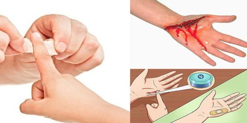 Điềm báo gì đằng sau những giấc mơ bị đứt tay